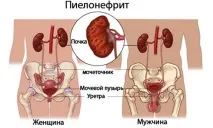 лечение симптоми