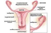 бременност бременност