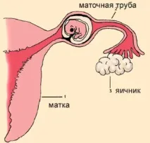 първа първа