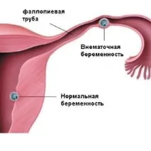 бременност бременност