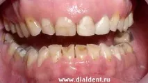 през нощта през нощта