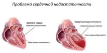 домашния любимец недостатъчност