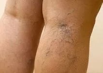 ногах