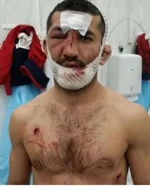 Стан Мірзаєва погіршився мірзаєва