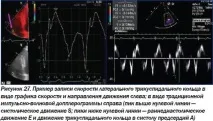 Сучасна ехокардіографічна оцінка правого шлуночка в клінічній практиці, Інтернет-видання правого