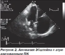 Сучасна ехокардіографічна оцінка правого шлуночка в клінічній практиці, Інтернет-видання сучасна