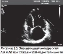 Сучасна ехокардіографічна оцінка правого шлуночка в клінічній практиці, Інтернет-видання правого