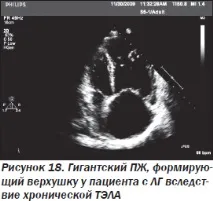 Сучасна ехокардіографічна оцінка правого шлуночка в клінічній практиці, Інтернет-видання сучасна