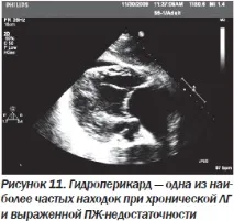 Сучасна ехокардіографічна оцінка правого шлуночка в клінічній практиці, Інтернет-видання правого