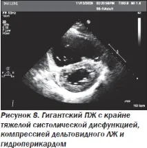 Сучасна ехокардіографічна оцінка правого шлуночка в клінічній практиці, Інтернет-видання оцінка
