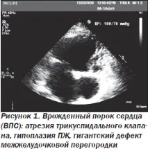Сучасна ехокардіографічна оцінка правого шлуночка в клінічній практиці, Інтернет-видання шлуночка