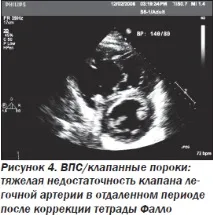 Сучасна ехокардіографічна оцінка правого шлуночка в клінічній практиці, Інтернет-видання правого