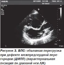 Сучасна ехокардіографічна оцінка правого шлуночка в клінічній практиці, Інтернет-видання сучасна