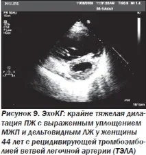 Сучасна ехокардіографічна оцінка правого шлуночка в клінічній практиці, Інтернет-видання ехокардіографічна