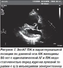 Сучасна ехокардіографічна оцінка правого шлуночка в клінічній практиці, Інтернет-видання правого