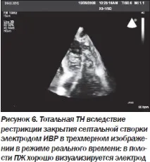 Сучасна ехокардіографічна оцінка правого шлуночка в клінічній практиці, Інтернет-видання ехокардіографічна
