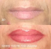 розтушуванням