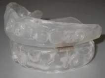 причини деца