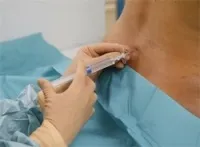 време операцията