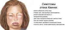 симптоми кърлежи