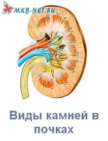 видове камъни