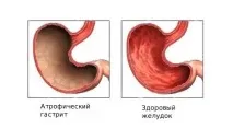 стомашно-чревния тракт микрофлората