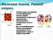 Хлороз у дітей хлороз