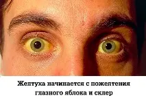 време бременност жълтеница