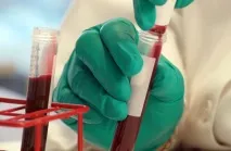 Гемофілія причини, види успадкування, лікування традиційними та народними засобами успадкування