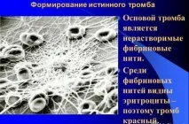 Гемофілія у дітей ознаки та причини виникнення дітей