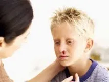 деца болести