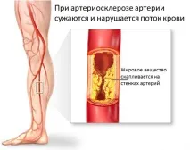 хепатромбин