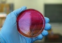 вулвовагинит лекува