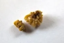 камъни камъни