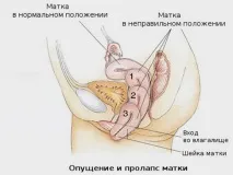 Як виконувати вправи Кегеля для жінок вправи