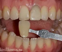 випадки