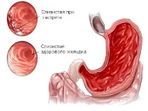 болка коремна