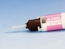 Цементи для тимчасової фіксації ортопедичних конструкцій цементи