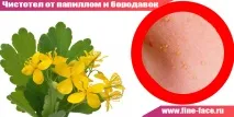 брадавици брадавици