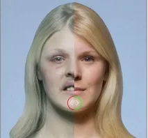 Фотосесія від фінських онкологів, як куріння, впливає на тіло людини. фотосесія