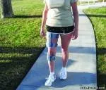 Лікування при розсіяному склерозі лікування