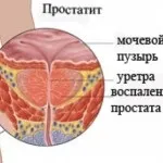 хроничен хроничен