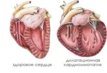 лечение такова заболяване