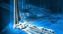 Як визначити (перевірити, виявити) плоскостопість у дітей та дорослих виявити