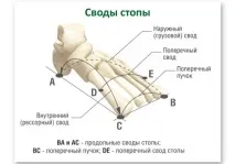 Як визначити (перевірити, виявити) плоскостопість у дітей та дорослих плоскостопість