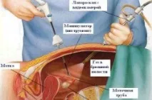 період