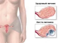 післяопераційний