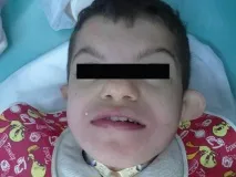 синдроми синдроми