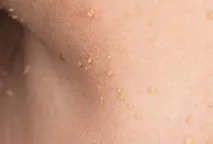 локално човешки