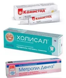 Мазі для ясен від запалення, кровоточивості, стоматиту. ясен